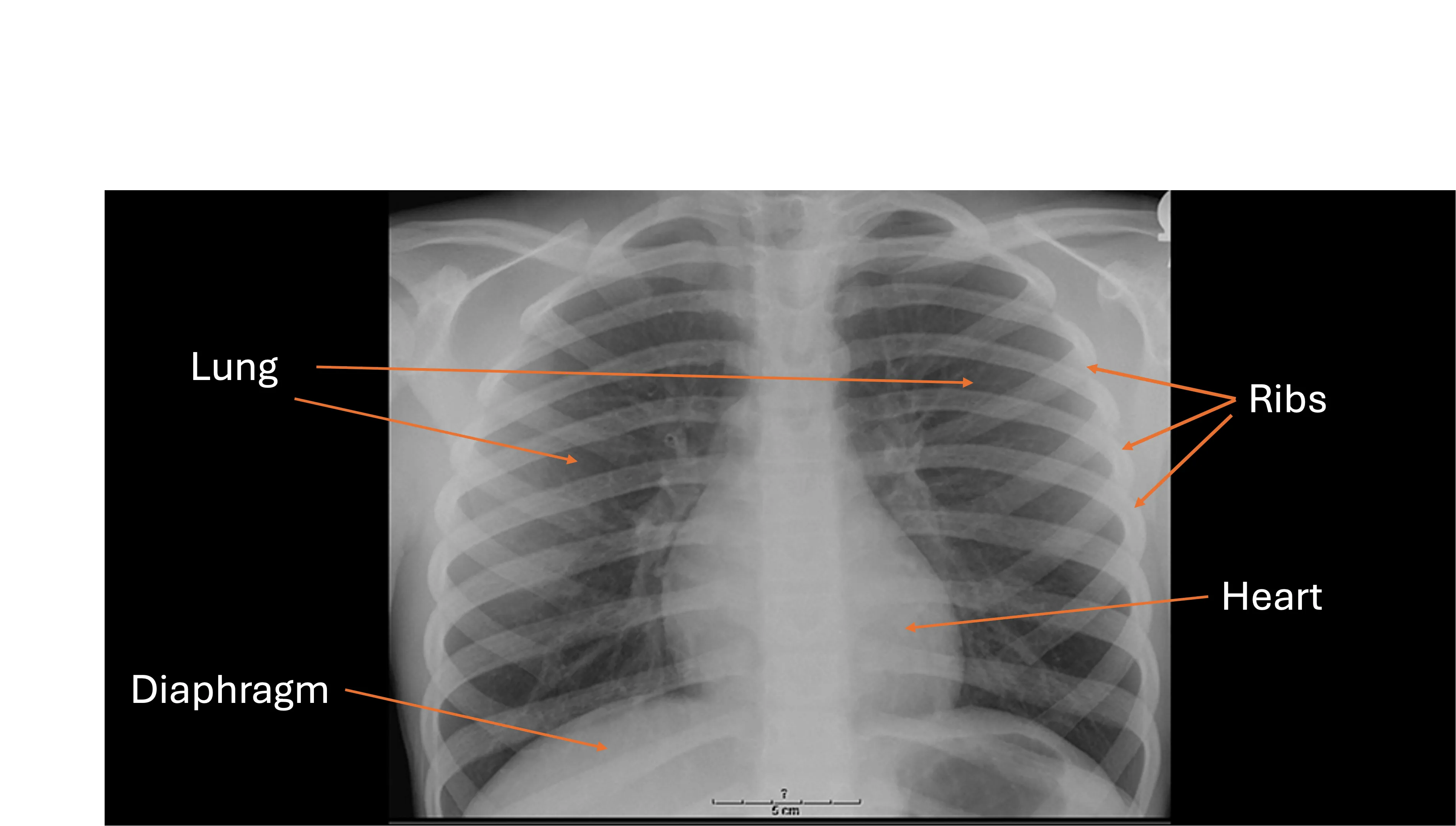 Child chest x-ray showing lungs and heart